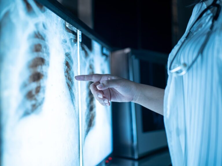 Scientists Discover Main Driver of Early-Stage Lung Cancer