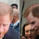 Prince Harry’s bald patch exposed in Australia.